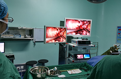 [Gynecological Laparoscopy] 4K Laparoscopic Ovarian Chocolate Cyst Surgery