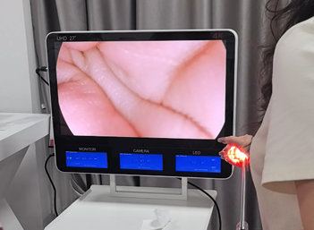 Portable 4K UHD Endoscopy Unit Gallery