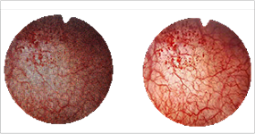 One-touch Twitching of Fiberscope Mode