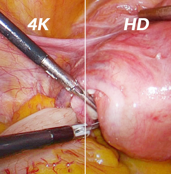 4k vs hd