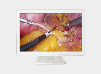 4K UHD Medical Endoscope Monitor 43" Gallery