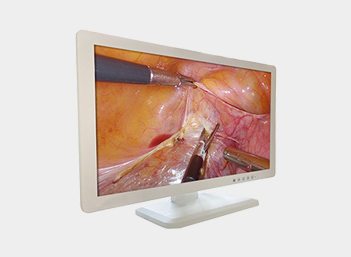 4K UHD Medical Endoscope Monitor 43" Gallery
