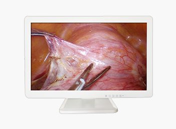 3D Medical Endoscope Monitor 32" Gallery