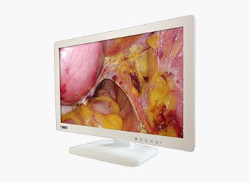 3D Medical Endoscope Monitor 32" Gallery