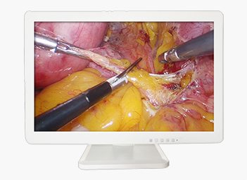 Medical FHD Endoscope Monitor 27" Gallery