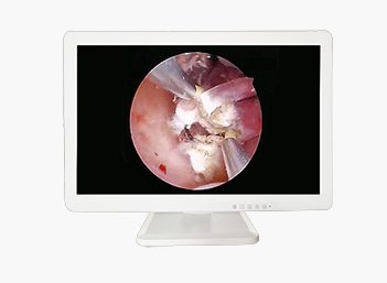 Medical HD Endoscope Monitor 21" Gallery