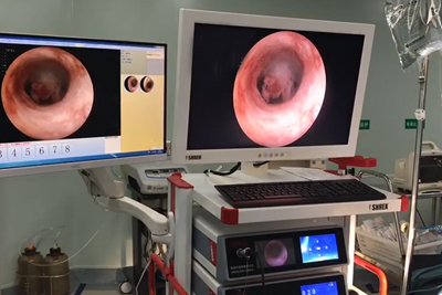 【Hysteroscopy】Endometrial Polyps